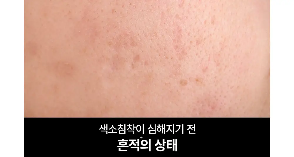 [흔적조준세럼/트라넥6%] 구달 청귤 비타C E TXA 세럼 30ml 기획 (+TXA 미스트 50ml) 상세페이지 6